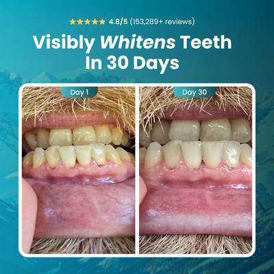 SMILEMORE™️ - Remineralizing Gum